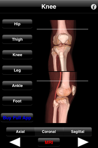 Monster Anatomy Lite - Knee free app screenshot 1
