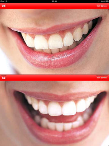 Dental Pic Compare screenshot 2