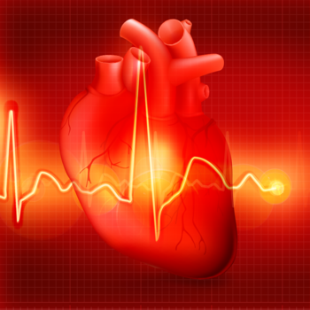 STEMI ST-Segment Elevation Myocardial Infarction LOGO-APP點子