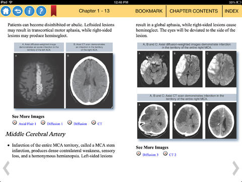 Neurology Video Textbook screenshot 4