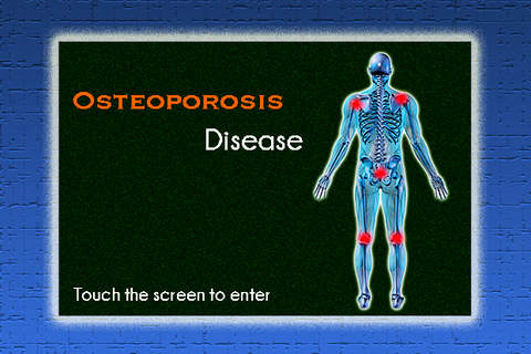 Osteoporosis Disease V1