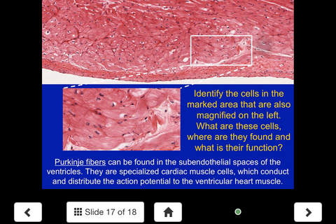 Histology - Cardiovascular and Lymphatic System screenshot 4