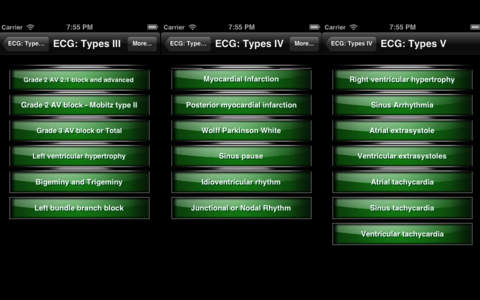 ECG Types Electrocardiogram screenshot 2
