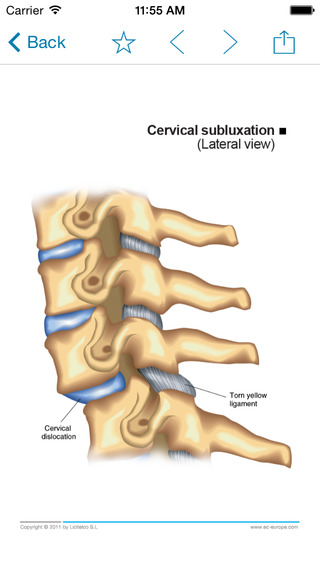 【免費醫療App】Miniatlas Musculoskeletal System-APP點子