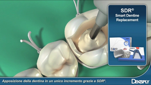 免費下載醫療APP|Dentsply-Endo-Resto-System app開箱文|APP開箱王