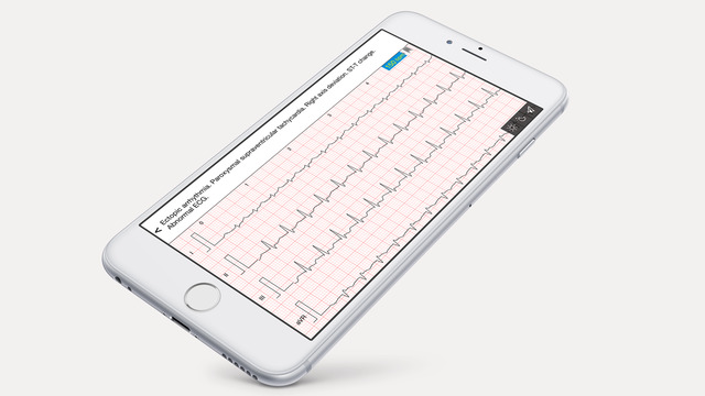 【免費醫療App】ECG Cases - 12 Lead electrocardiogram (EKG) for cardiology study-APP點子