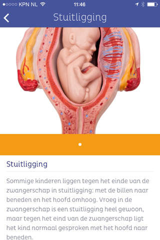 ZwApp - unieke zwangeren app! screenshot 4