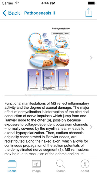 【免費醫療App】Miniatlas Multiple Sclerosis-APP點子