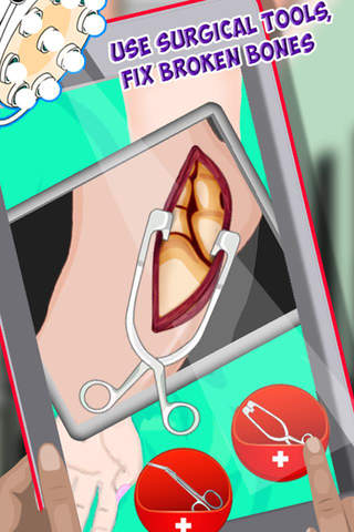 Elbow Surgery Doctor - Treat Injured Patients in this free Crazy surgeon Hospital Doctor Game for kids screenshot 3