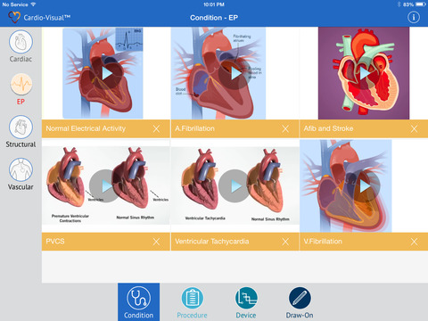 免費下載醫療APP|Cardio-Visual Lite app開箱文|APP開箱王