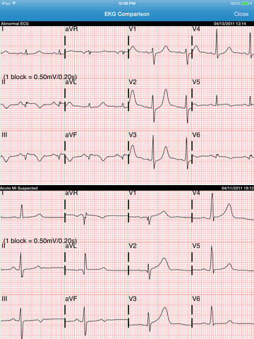 【免費健康App】Vocera Cardiac Consult HD-APP點子