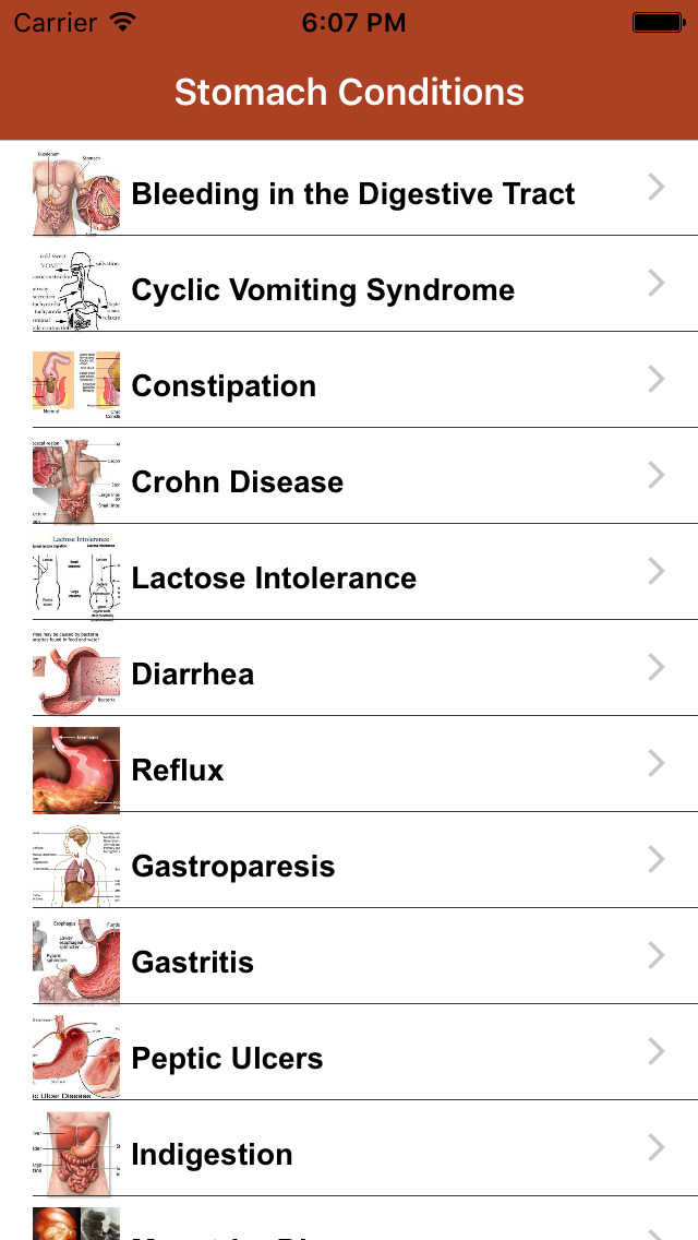 App Shopper Stomach Conditions & Treatment (Lifestyle)