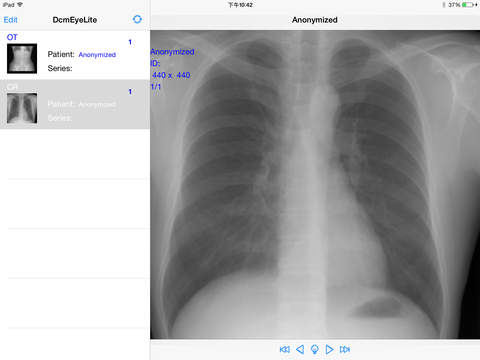 【免費醫療App】DcmEye Lite 2-APP點子