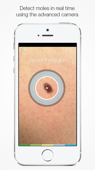 SkinVision – Melanoma detection app and skin health monitor