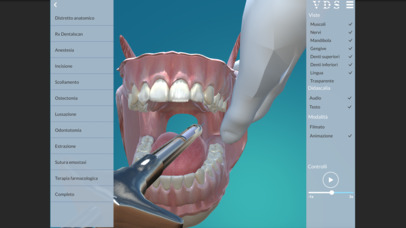 VDS - Visual Dental Surgery - 8° inferiore incluso screenshot 2