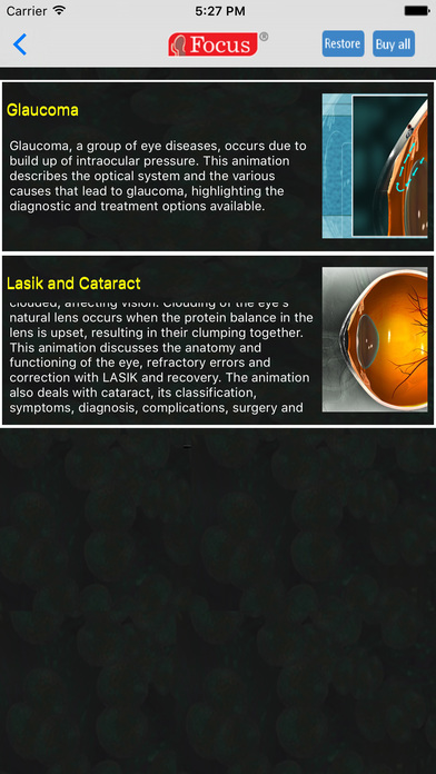 Ophthalmology - Understanding Disease screenshot 2