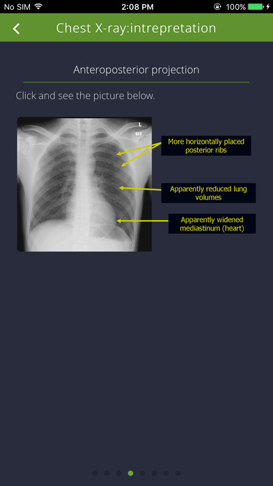 Chest Radiographs screenshot 3