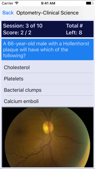 Optometry Board Reviews screenshot 2