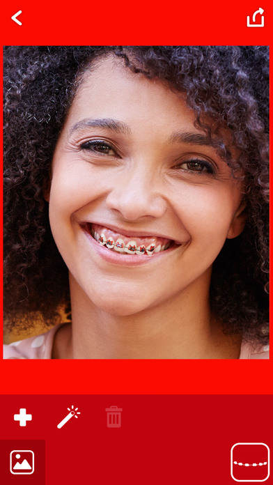 Fake Braces Photo Montage – Stickers for Pictures screenshot 4