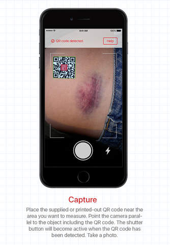 imitoMeasure - Wound and Specimen Measurement Medical