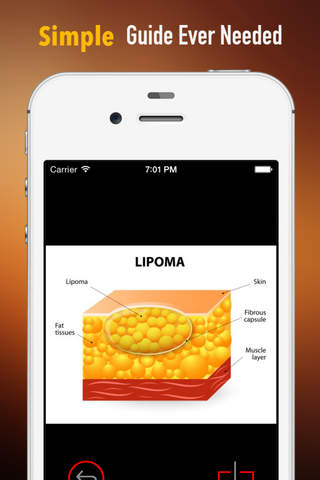 How to Cure Lipomas Naturally:Tips and Tutorial screenshot 2