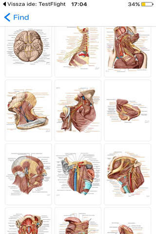RF Human Anatomy Atlas screenshot 4