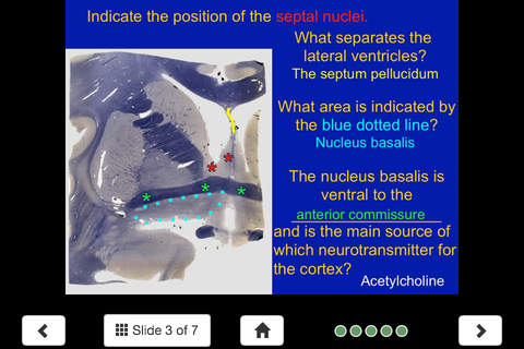 Neuroanatomy Lite - SecondLook screenshot 4