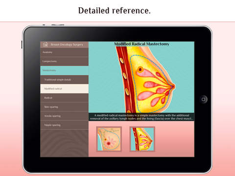 Stanford Medicine Breast Reconstructive Surgery screenshot 3