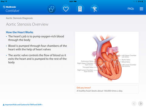 【免費醫療App】Aortic Stenosis Patient Journey-APP點子