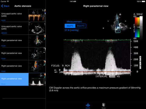 【免費醫療App】CARDIO3® Comprehensive Atlas of Echocardiography [HD]-APP點子