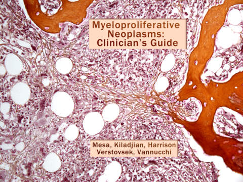 MPN Clinician's Guide