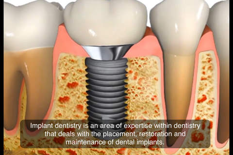 Dental Education - by Oral-B screenshot 4