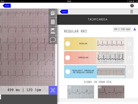 【免費醫療App】ECG Camera-APP點子