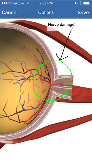 【免費醫療App】Eye Decide - Patient Engagement Tools for Healthcare Providers-APP點子