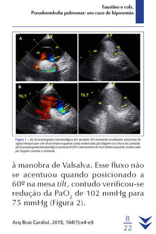 SBC Arquivos Brasileiros de Cardiologia screenshot 3