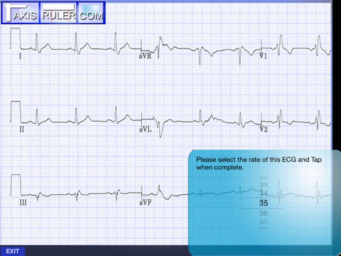 【免費醫療App】ECG Genius-APP點子