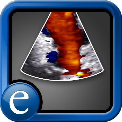 Echocardiography Atlas edited by Scott D. Solomon, MD