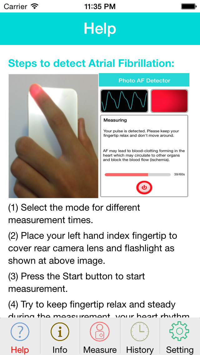 Photo AFib Detector Apps 148Apps