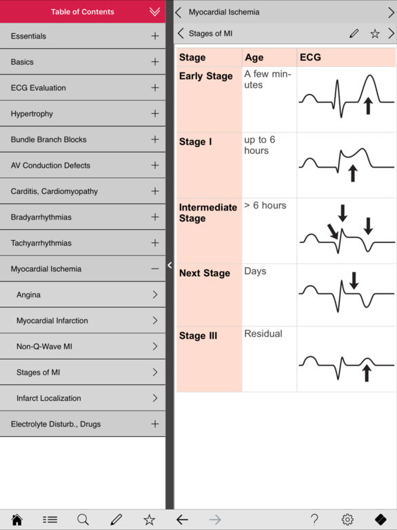 App Shopper: ECG pocketcards (Medical)