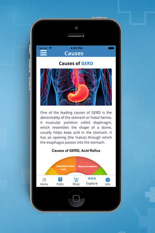 GERD, Heartburn and Acid Reflux Symptoms & Remedie - náhled