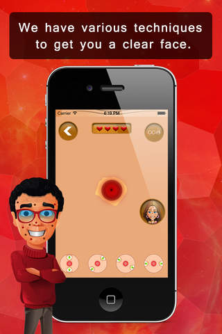 Pimples & Acne Popper Lite - náhled