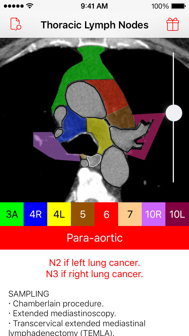 Thoracic Lymph Node Map (ios)