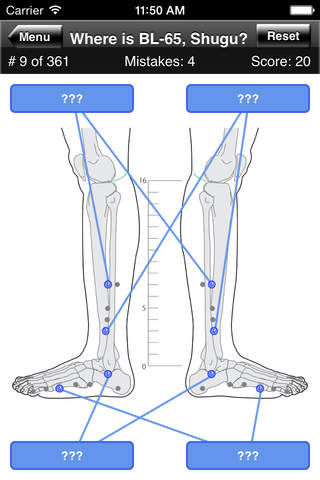 Acupuncture Points Body Quiz - náhled